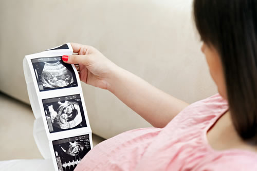 Prenatal Screening Tests